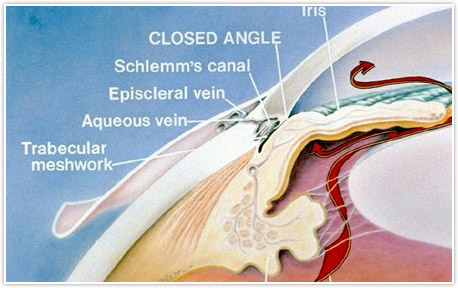 Strabismus Detroit - Crossed Eyes Rochester - Dr. Weingarten