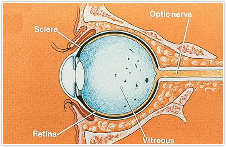 Eye Floaters Diagram Detroit